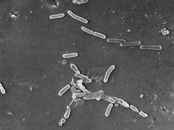 Superbacterias causan más de 1.2 millones de muertes