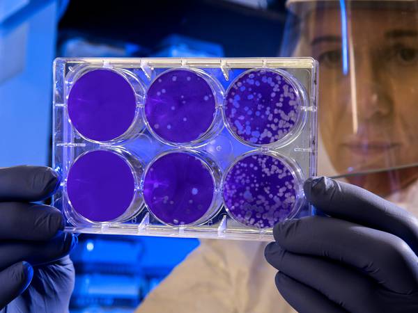 Estudio: La microgravedad del espacio podría acelerar la producción de células madres para tratar enfermedades