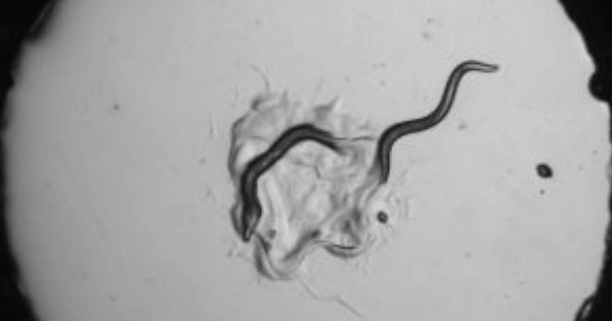 Study discovers worms that make complex decisions