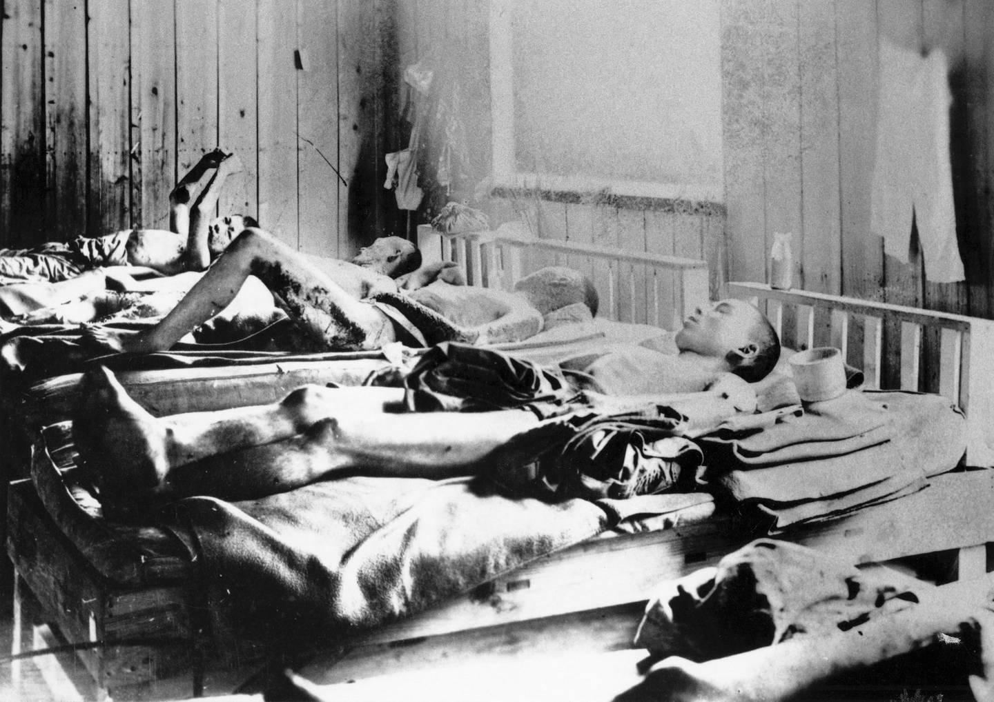 Civiles japoneses sufrieron el efecto de la radiación tras el lanzamiento de la bomba atómica de Hiroshima.