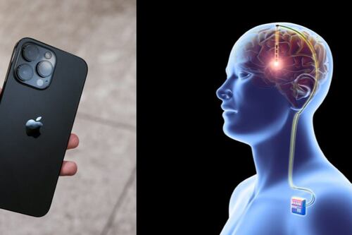 Apple desarrollará implantes cerebrales con un socio estratégico (y no es ciencia ficción)