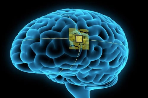Empresa rival de Neuralink logra instalar su primer chip cerebral tras recibir permisos de operación en EE.UU