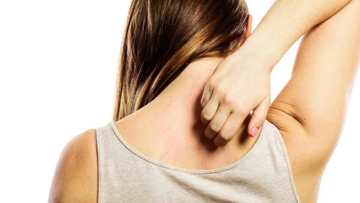 Rascarse la piel: Un placer culposo que tiene pros y contras, según la ciencia