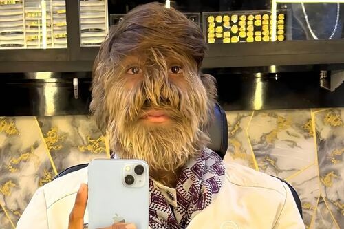 Cuál es la condición genética de Lalit Patidar, el hombre Record Guinness por tener el rostro más peludo del mundo