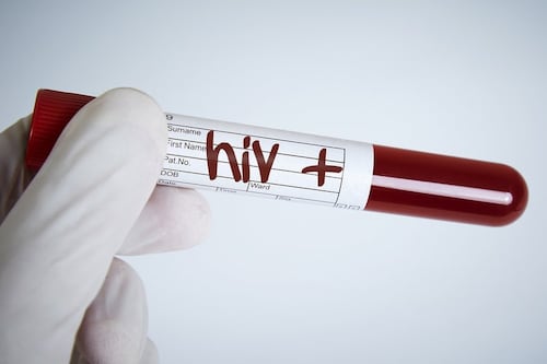 VIH: Científicos buscan la manera de tratarla con una sola inyección efectiva