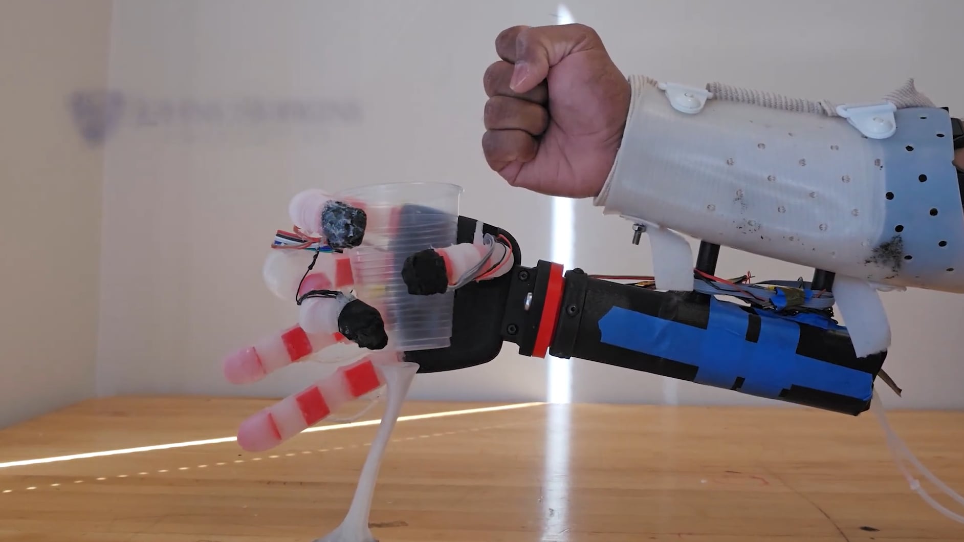 La nueva mano biónica es la que más se acerca a imitar el tacto humano