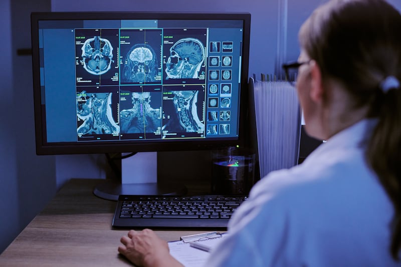 Así afecta la violencia de género al cerebro de las mujeres