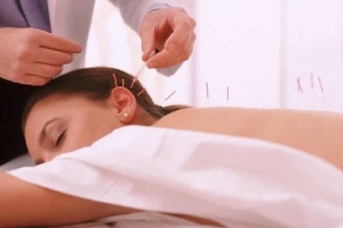 ¿La acupuntura miente? Científico examina la medicina tradicional 