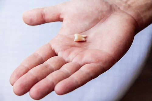 Desarrollan en Corea del Sur un parche de microagujas capaz de regenerar dientes