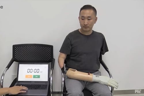 MIT fabrica una prótesis de mano de bajo costo capaz de hacer que sus usuarios vuelvan a sentir