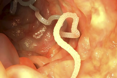 Conoce al gusano de crin, el peligroso parásito que controla la mente de su víctima