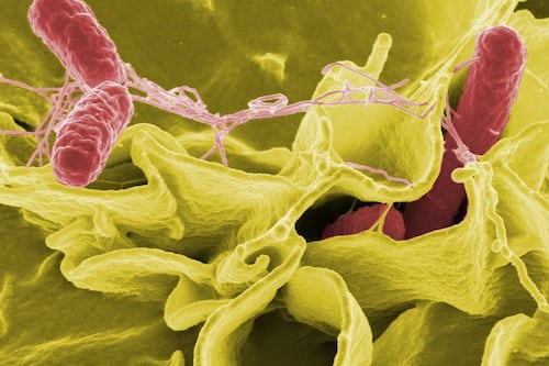 Qué es la salmonella: la bacteria que afectó a 80 personas en Maipú