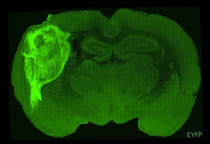 Cerebro de rata con implante