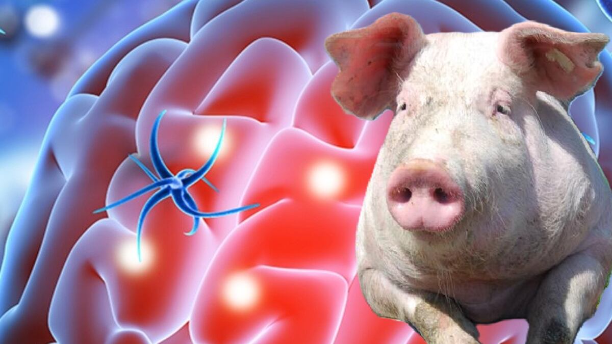 Científicos chinos lograron un hito sin precedentes | Revivieron el cerebro de un cerdo una hora después de muerto – FayerWayer
