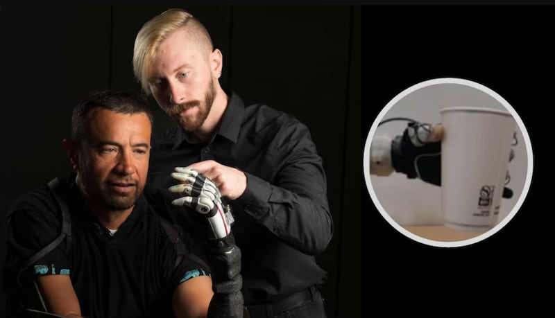 Nueva prótesis con IA