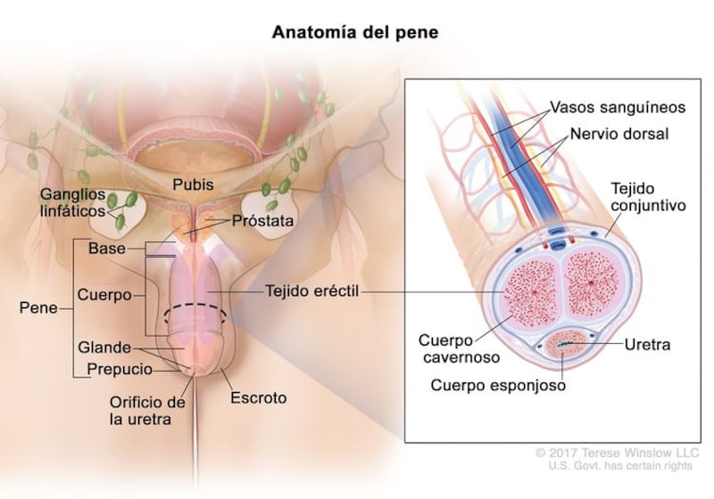 Cáncer de pene