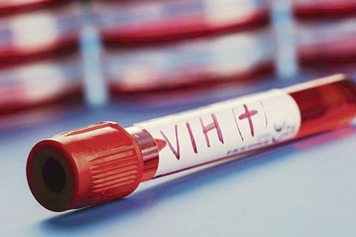 Descubren una nueva variante del VIH más dañina y transmisible que las ya conocidas