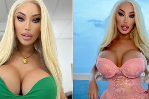 “Es perturbador”: La Barbie Humana, que antes era Ken, posa en bikini tras operaciones y la destruyen en redes