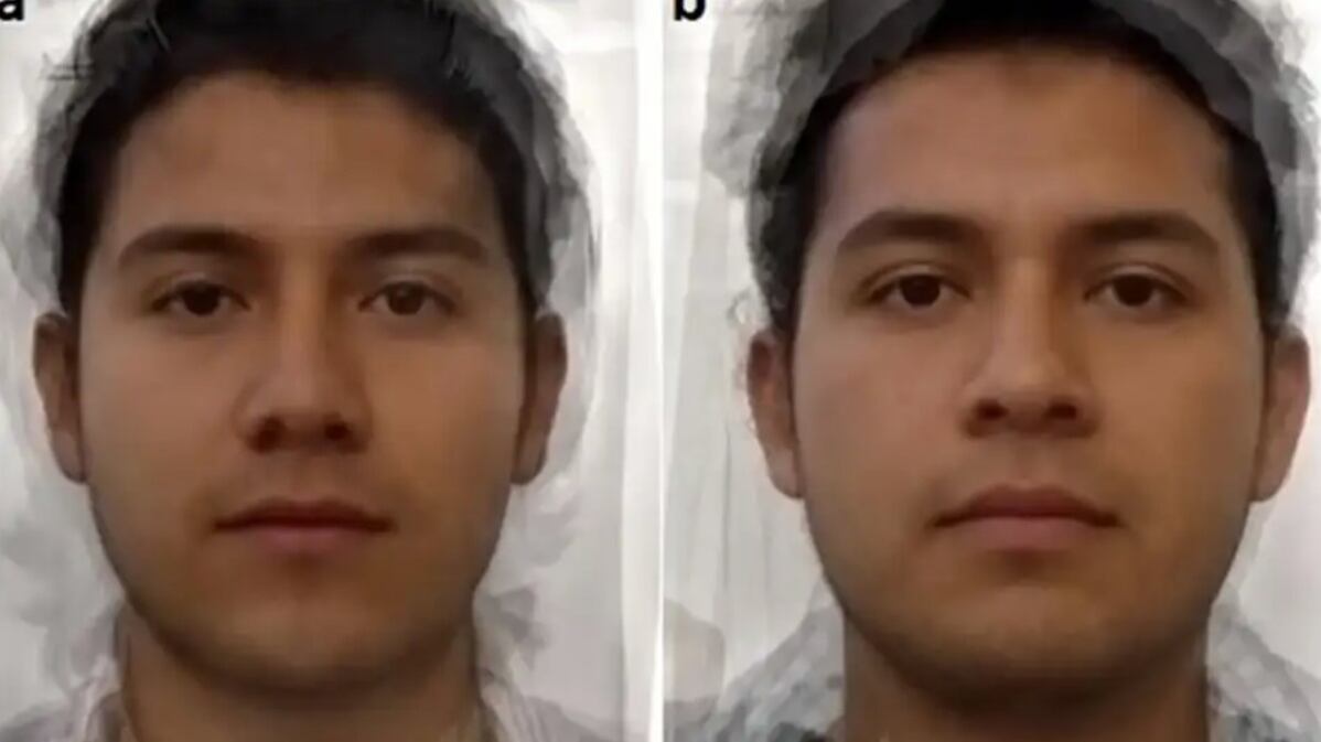 Comparativa de voluntarios. A la izquierda, el infectado con toxoplasmosis, a la derecha el no infectado.