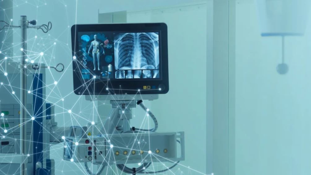 Inteligencia Artificial para la detección de enfermedades pulmonares