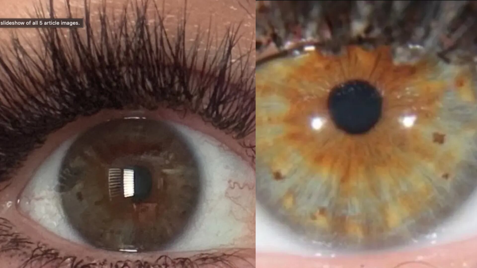 Mujer sobrevivió a un rayo