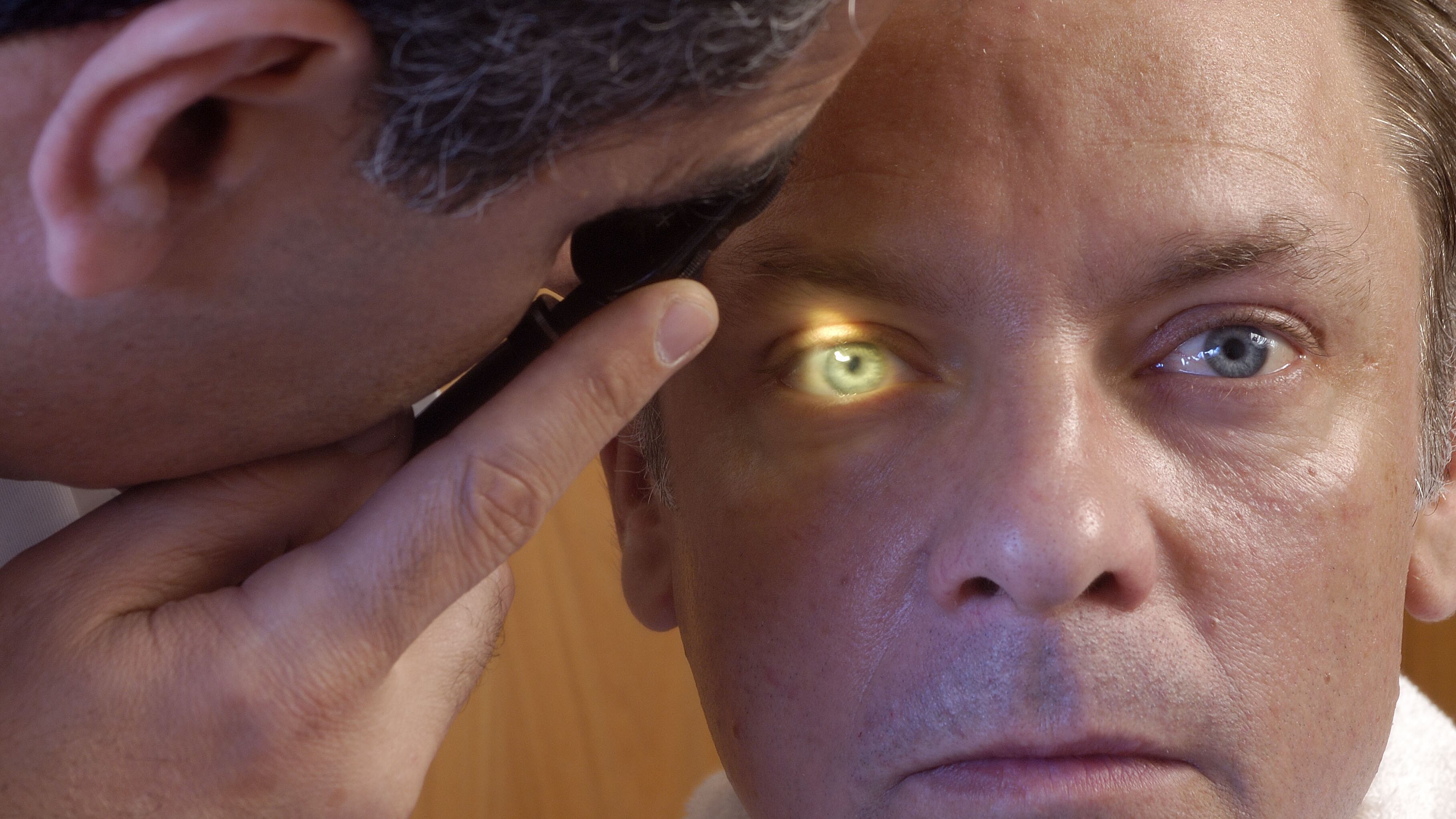 Los adultos mayores son quienes más sufren de los ojos por glaucoma.