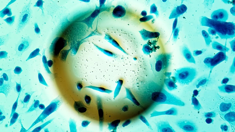 Día Nacional de la lucha contra el cáncer de próstata