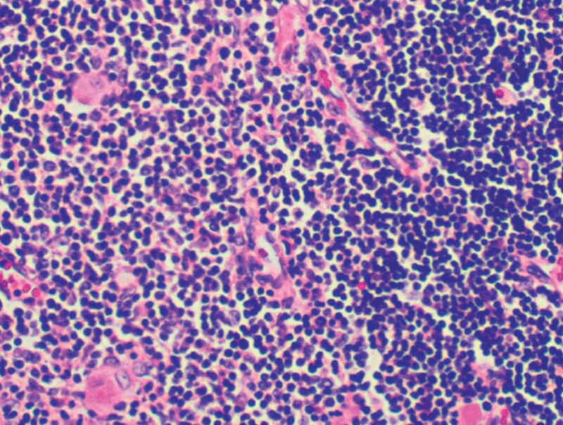 Células T Reguladoras