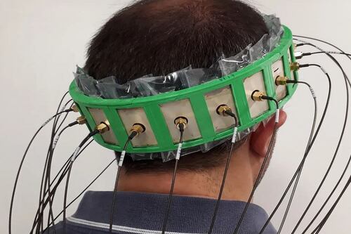 Investigadores crean casco inteligente que puede diagnosticar accidentes cerebrovasculares