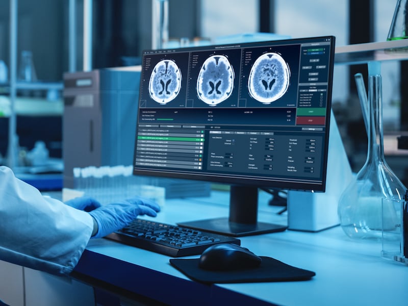 IA con doctorado: Científicos logran que algoritmos “entiendan” la química como si fuera lenguaje humano