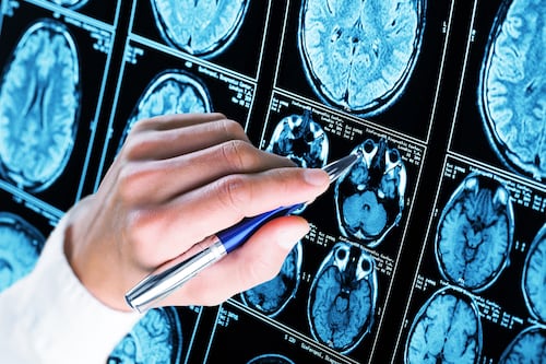 Investigadores descubren la red cerebral que une al cuerpo y mente