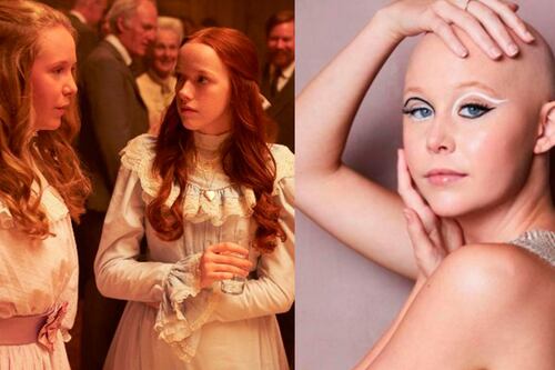 Actriz de “Anne with an E” vence el cáncer a sus 20 como guerrera y muestra las cicatrices que le dejó