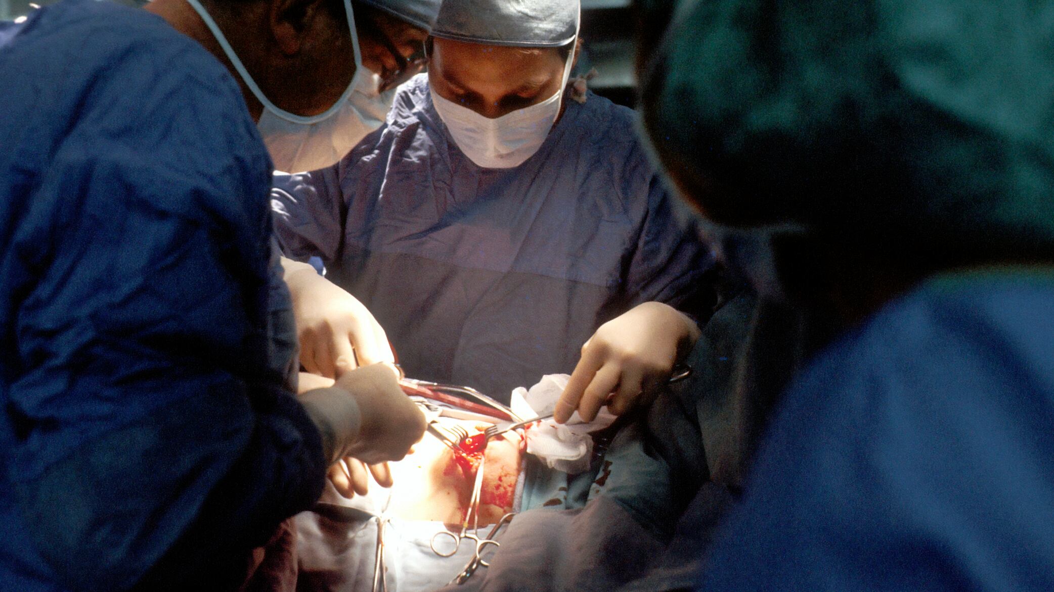 La posibilidad de utilizar órganos de cerdos genéticamente modificados para satisfacer esta demanda ha sido una luz de esperanza en la medicina moderna.