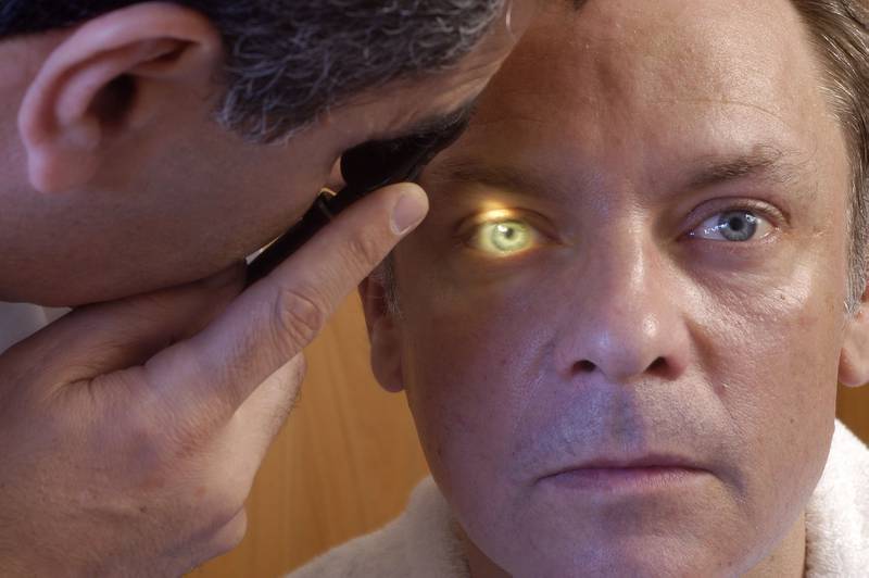 Los adultos mayores son quienes más sufren de los ojos por glaucoma.