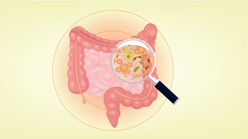 Los casos ce Cáncer de colón estan afectando a personas menores de 50 años | Foto: Referencial